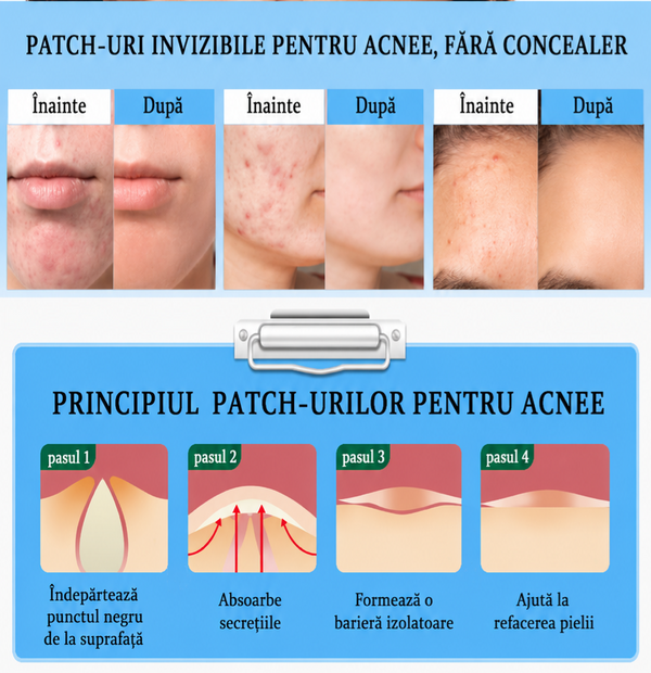 Patch-uri Anti-Coșuri Magice